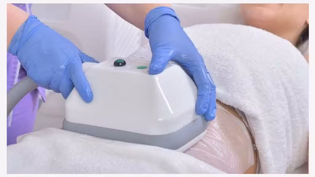 Vente centre médico esthétique cryolipolyse 57