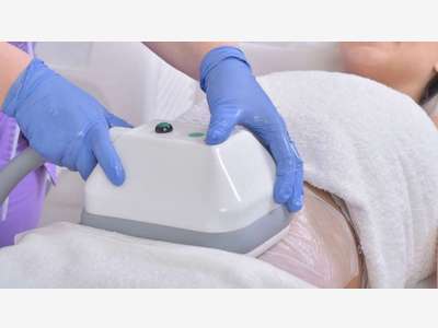 Vente centre médico esthétique cryolipolyse 57